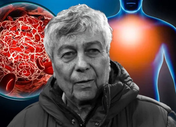 Ce înseamnă „focarele de tromboembolism pulmonar”. Explicația medicală a uneia dintre afecțiunile grave